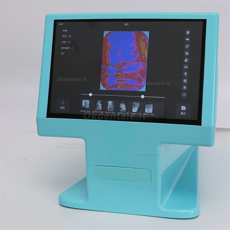 Scanner ai fosfori per immagini intraorali Dynamic® DDT-100A con display ad alta risoluzione