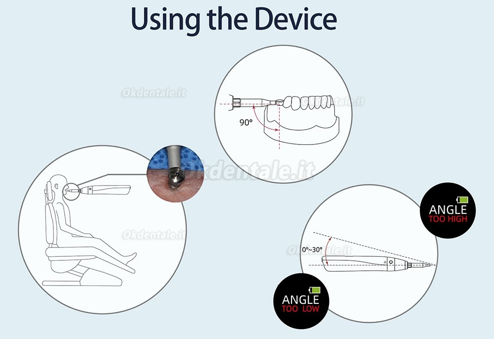 ISQ Misuratore Stabilità Implantare YAHOPE iCHECK, Modulo di misura della stabilità dell'impianto