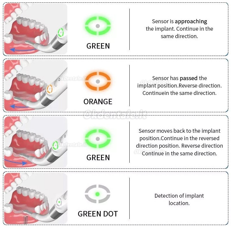 Kit localizzatore di impianti dentali YAHOPE iD1, Localizzatore implantare